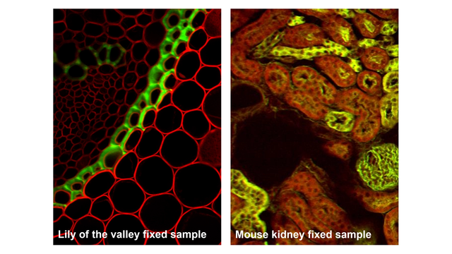 Data taken with FemtoFiber ultra 920 fiber delivery on Bergamo® II Multiphoton Microscope (Green and red channel)