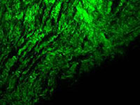 SHG Microscopy