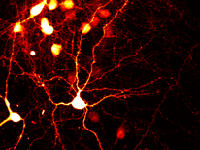 Time-Resolved Microscopy