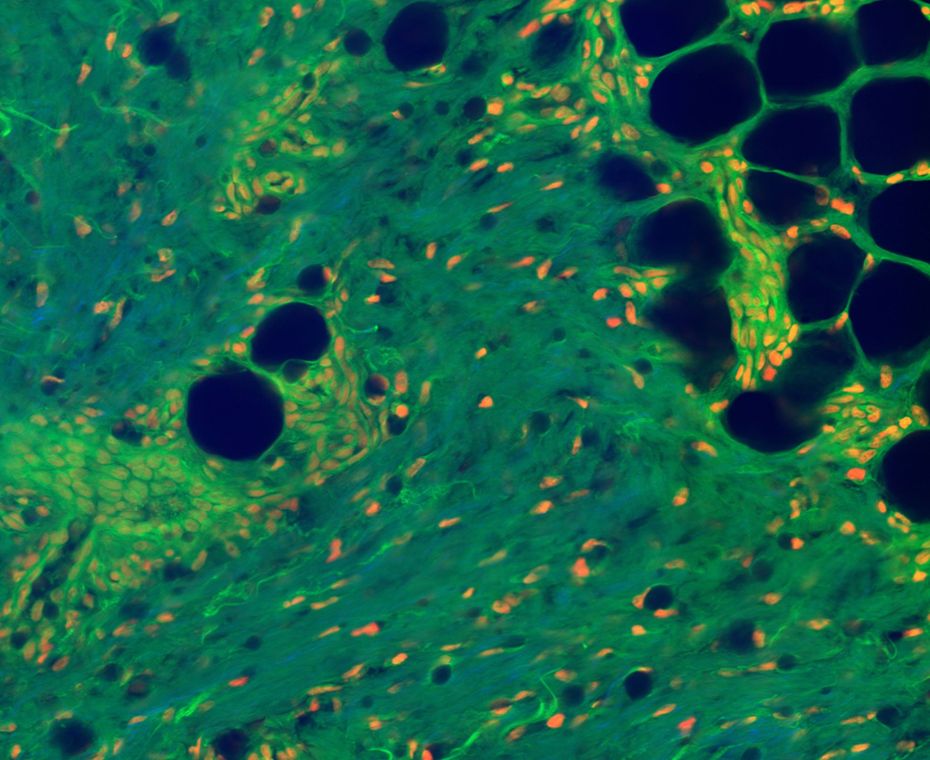 Magnification: Green is a fluorescent protein stain, red is a DNA stain, and blue is SHG in ordered Collagen tissue. DNA clusters in cell nuclei, proteins cluster in cell bodies, and collagen fibers form connective tissue in the skin sample. All images: Prof. Michael Giacomelli / University of Rochester